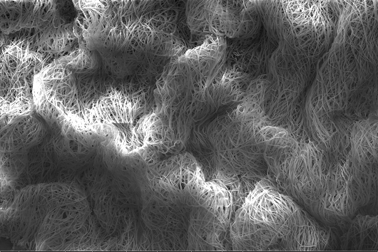Biofilme de Fusarium solani (espécie de fungo) formado em lente de contato Alphafilcon A (Autores: Ewerton Weslley Caracas Cedro; Fernando Victor Monteiro Portela; Ana Raquel Colares de Andrade; Rossana de Aguiar Cordeiro)